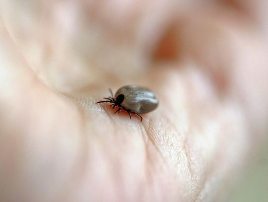 Nikt nie chciał wyciągnąć jej dziecku kleszcza. Matka z dzieckiem była odsyłana od drzwi do drzwi