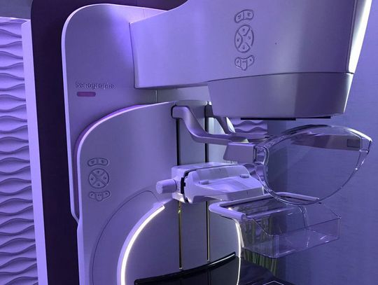 Szpital w Kędzierzynie-Koźlu będzie miał supernowoczesny mammograf. Zakup sfinansowany przez powiat i Unię