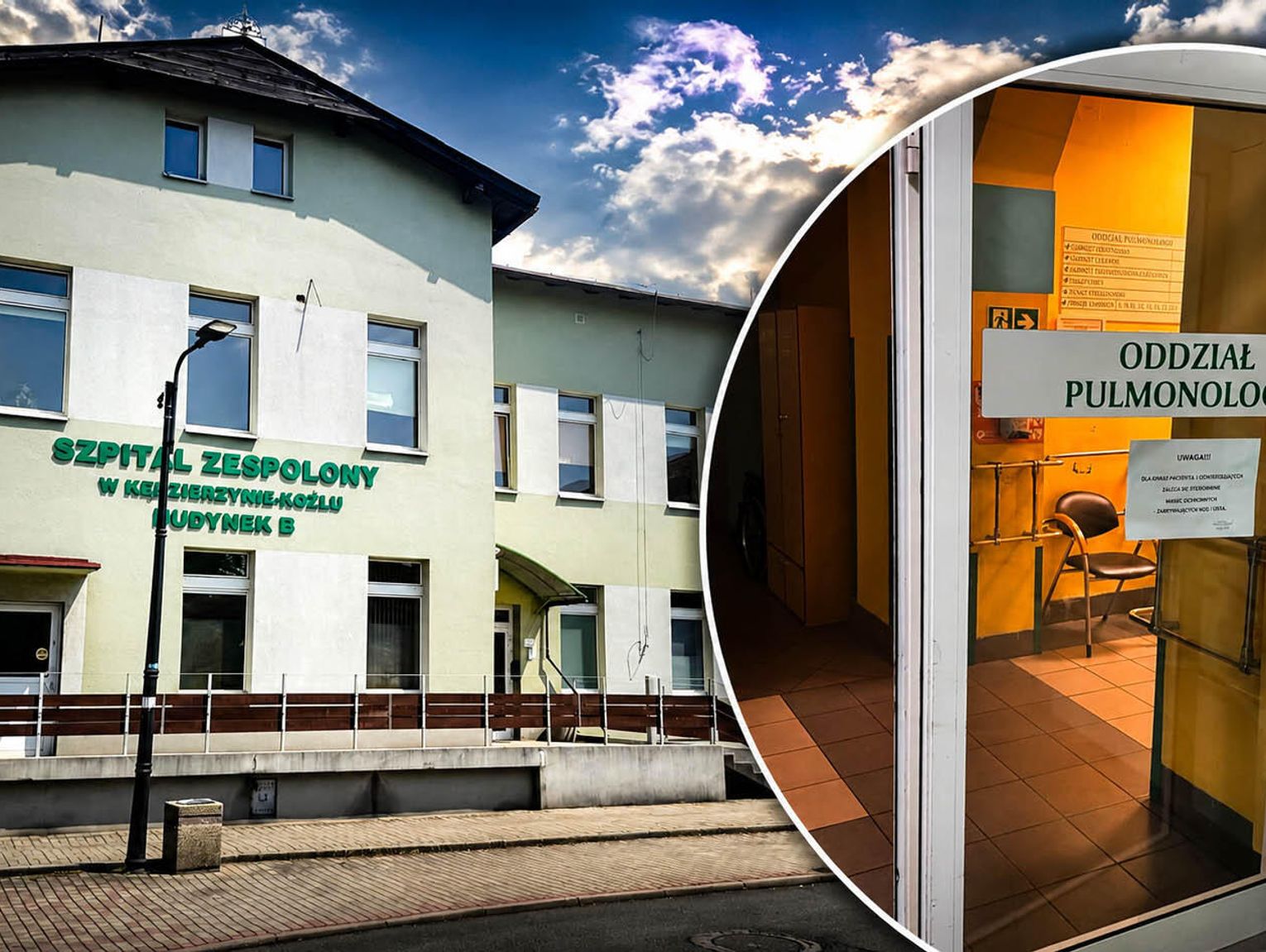 Szpital w Kędzierzynie-Koźlu zamyka Oddział Pulmonologiczny. Główny powód brak lekarzy
